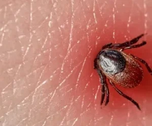 Tick bite
